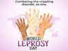 World Leprosy Day 2023: What expert says about Hansen’s Disease myths? Know facts about battling leprosy