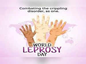 World Leprosy Day 2023:  What expert says about Hansen’s Disease myths? Know facts about battling leprosy