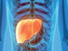 Covid-19 patients are far more likely to develop chronic liver problems: Study