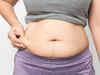 Daughters of overweight mothers at greater risk of obesity, says new study