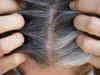 Having premature grey hair? Stem cells may be the culprit, claims study