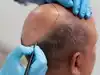 Image for Court orders hair transplant clinic