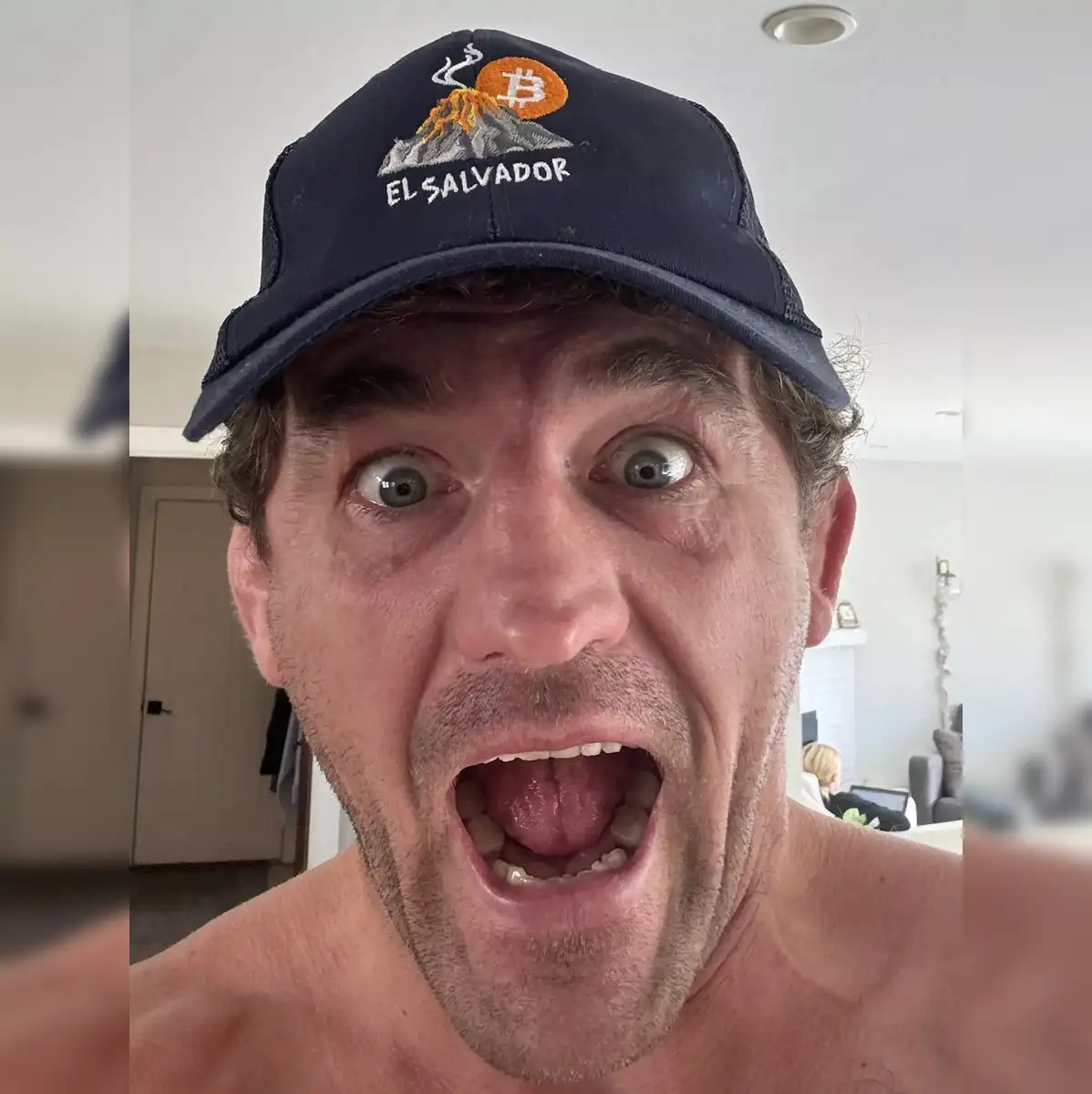 MMA legend Ben Askren hospitalized in Critical condition with severe  Pneumonia, family asks for prayers - The Economic Times