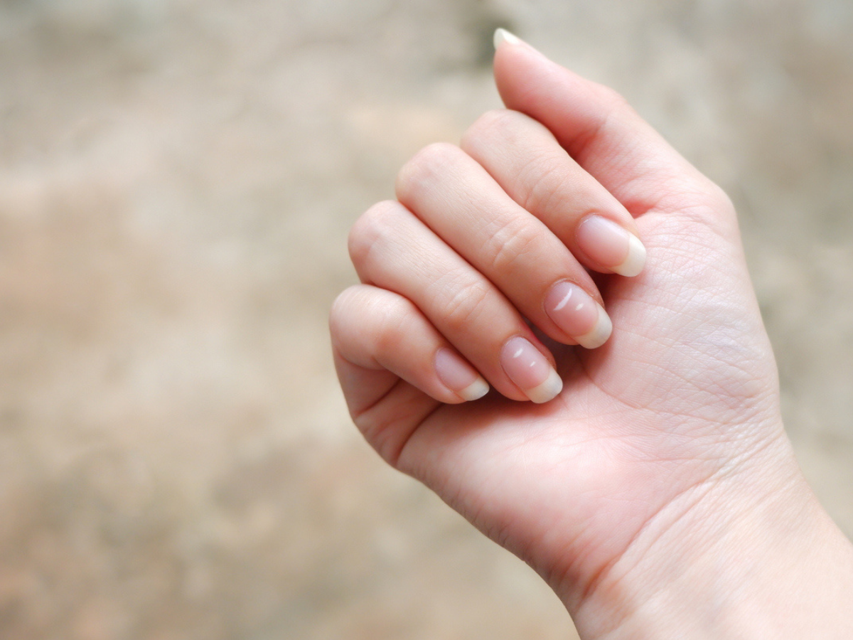 Why We Get White Marks on Our Nails