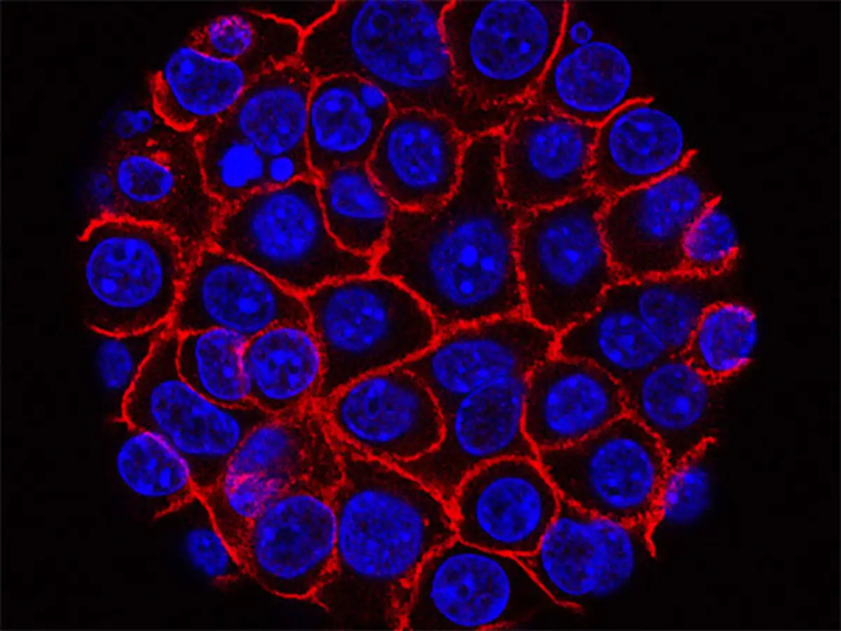 Cancer Treatment Genomic Tests For Cancer Split Oncologists Best genetic testing company in india. genomic tests for cancer split oncologists