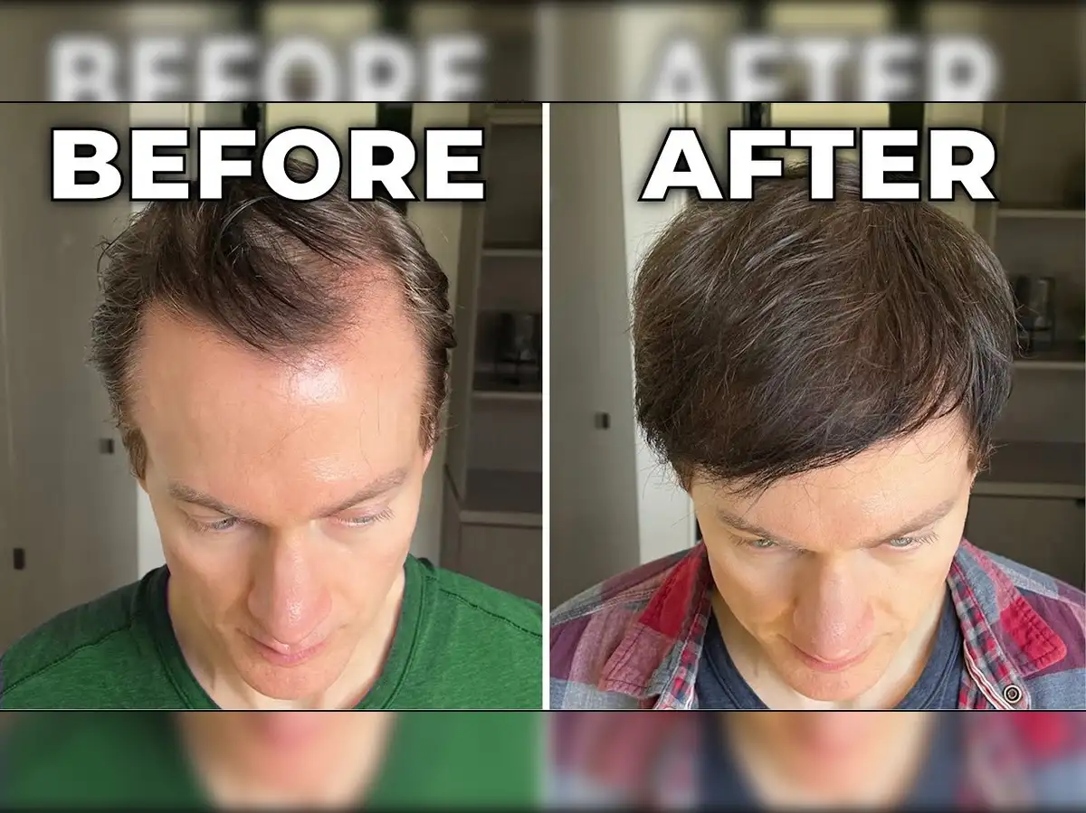 Bryan Johnson Hair Care: Ultimate Tips for Healthy, Strong Hair