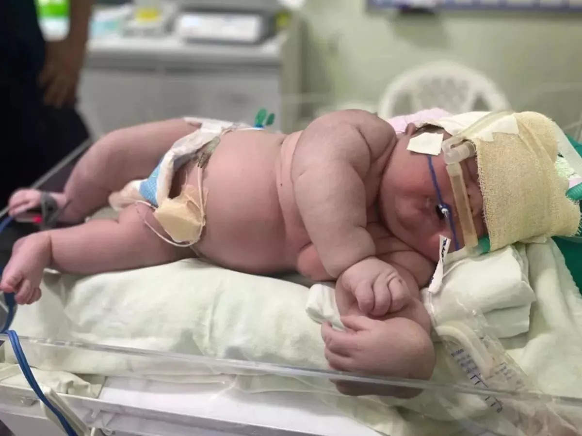 https://img.etimg.com/thumb/width-1200,height-900,imgsize-38456,resizemode-75,msid-97543168/magazines/panache/two-foot-tall-infant-weighing-almost-8kg-born-in-brazil-get-to-know-macrosomia-the-condition-that-creates-gigantic-babies.jpg