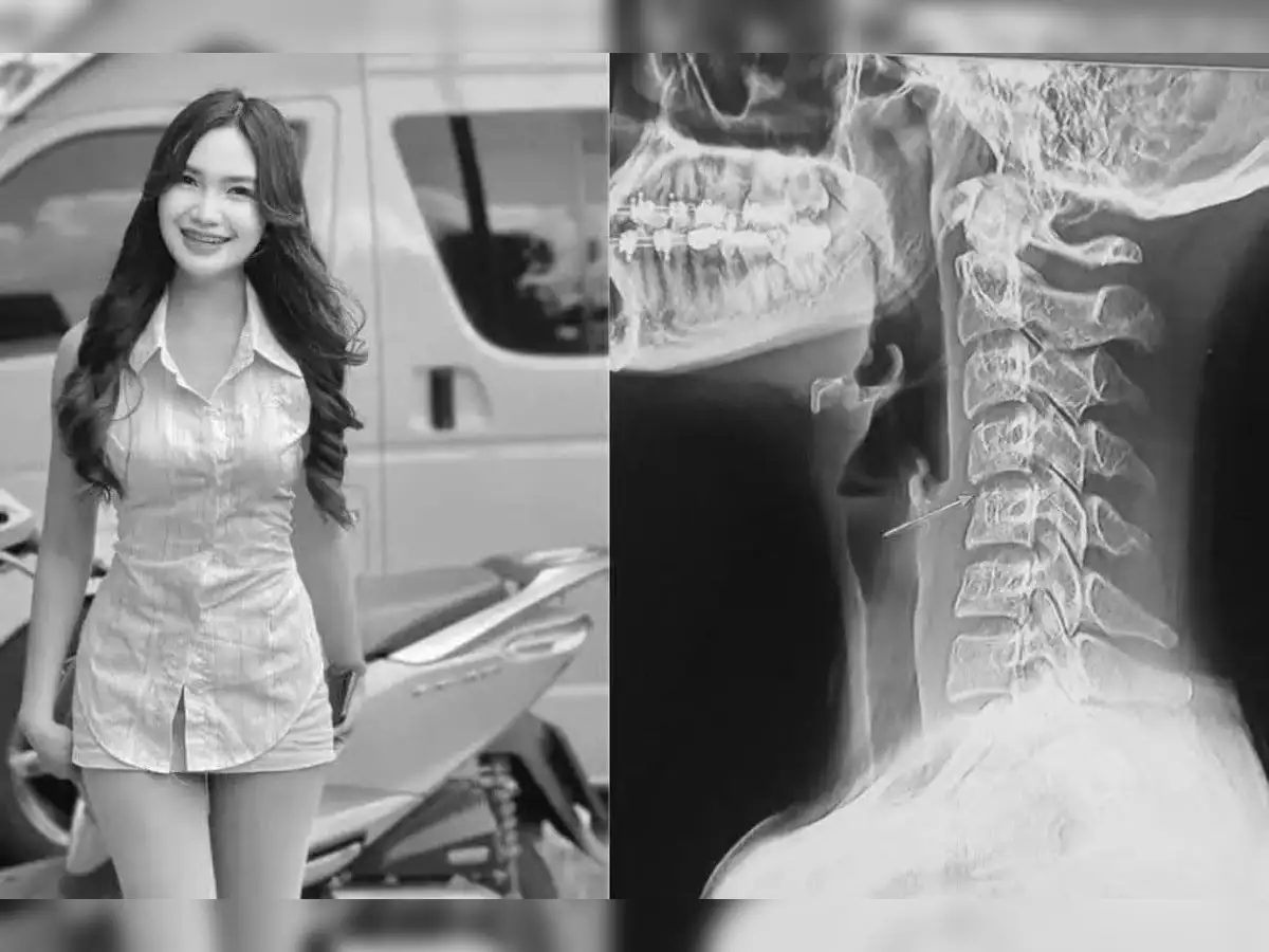 Pop Singer Ping Chayada dies after Thai massage. Heres what went wrong -  The Economic Times