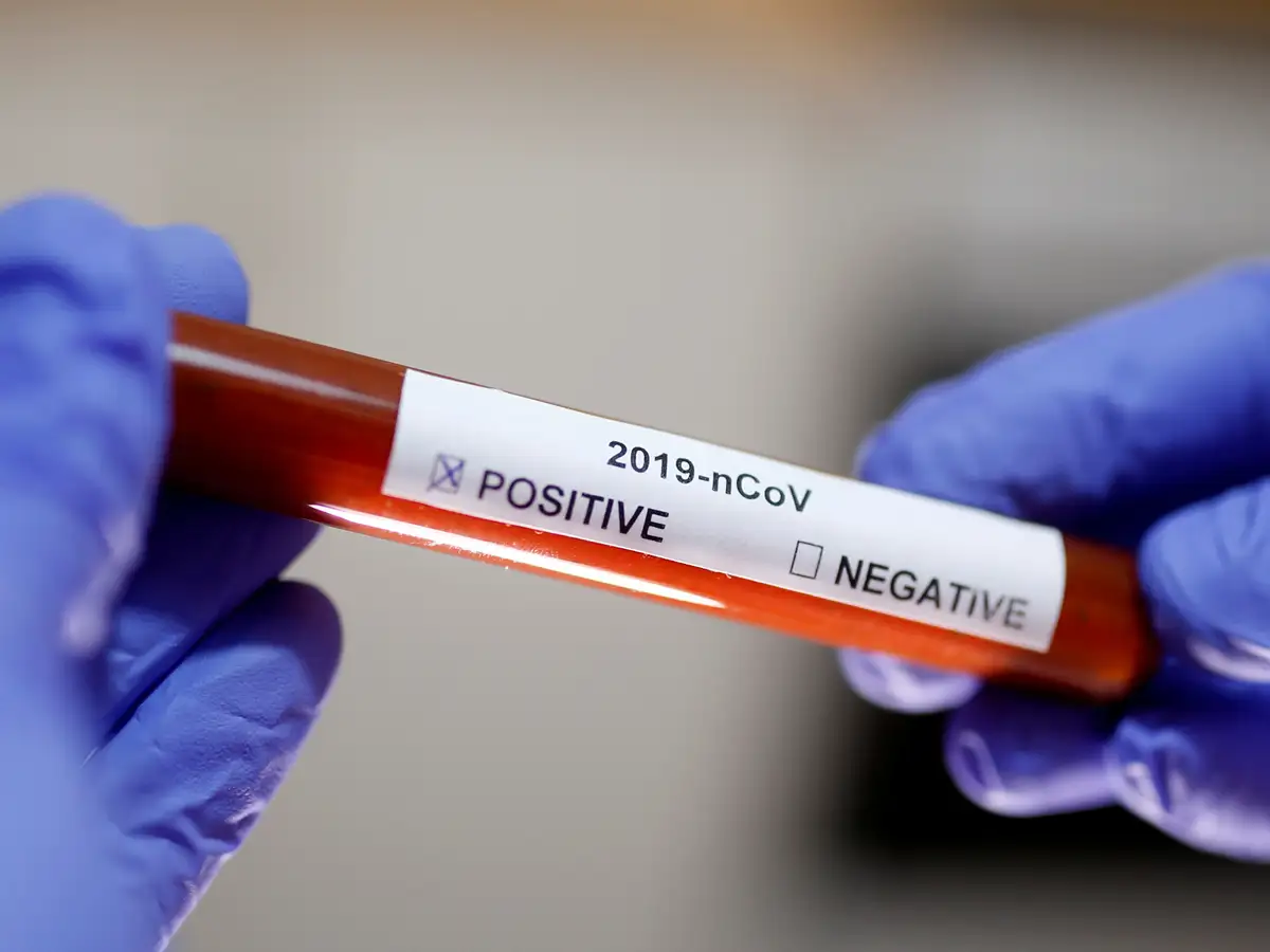 Coronavirus In Nashik Dubai Returned Nashik Woman Mother Quarantined