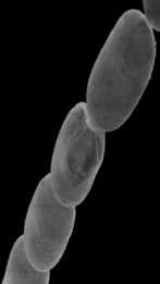Giant bacteria discovered. It's world's largest