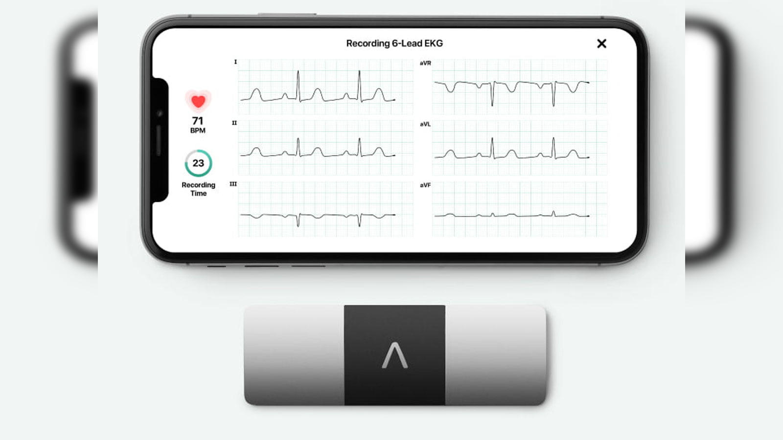 Buy AliveCor EKG device? - Blood pressure monitor.shop