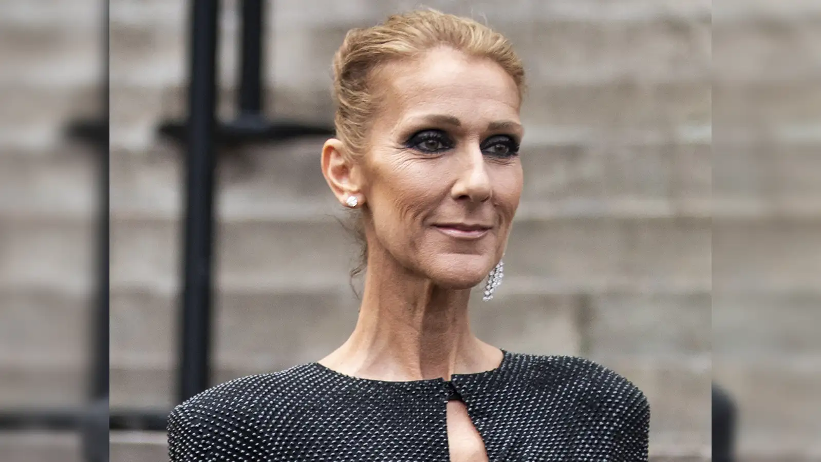 stiff person syndrome: What is stiff-person syndrome, a rare neurological  condition Celine Dion suffers from? - The Economic Times