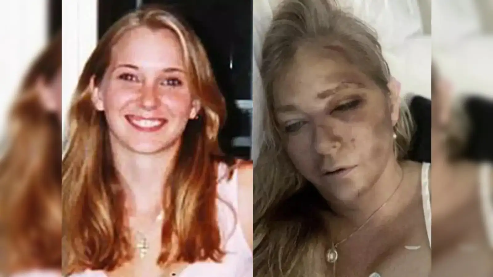 Who is Virginia Giuffre? Epstein scandal whistleblower with 'days left to  live' - The Economic Times