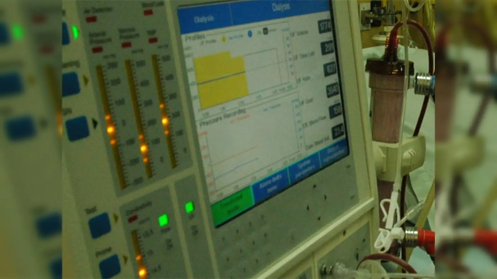 BPL Medical Technologies acquires UK-based Penlon - The Economic Times