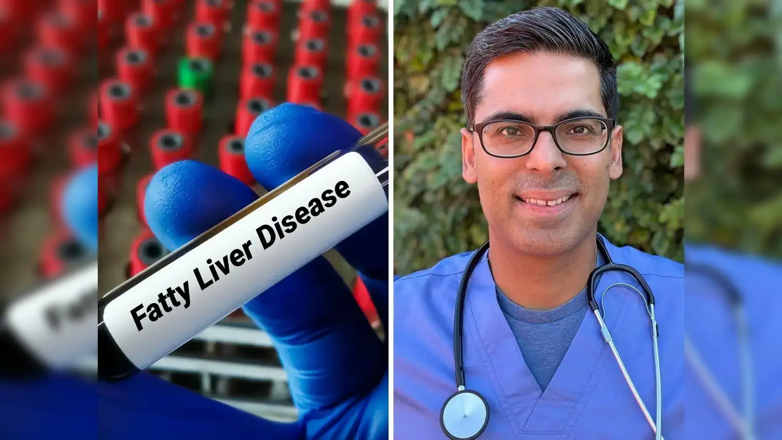 Struggling with fatty liver? Harvard-trained gut doctor shares 7 simple foods that may help reverse the damage