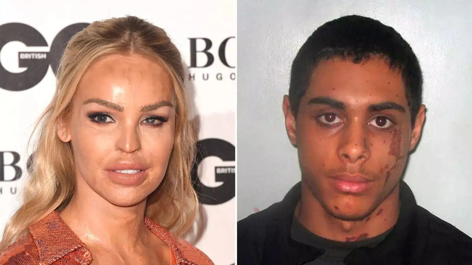 Katie Piper Antes E Depois Katie Piper Before Attack