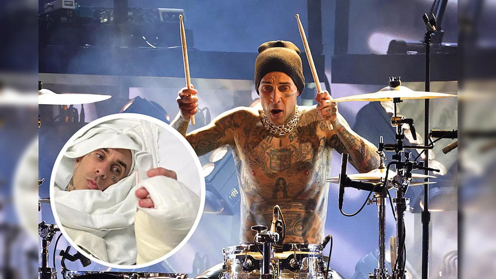 travis barker Blink 182 drummer Travis Barker s injury Here s