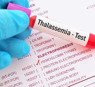 World Thalassemia Day: Green Veggies, Dates, Raisins And Other Foods To Avoid And Why