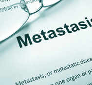 Metastatic Cancer: Myths Vs Facts