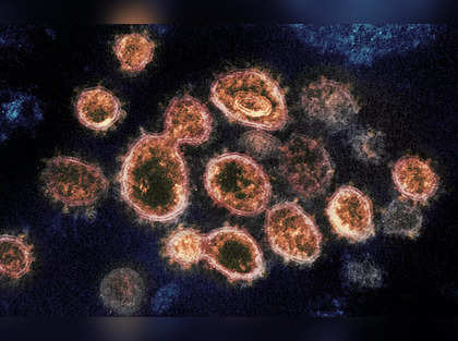 Urgency lacking as TB passes Covid as biggest killer: Expert