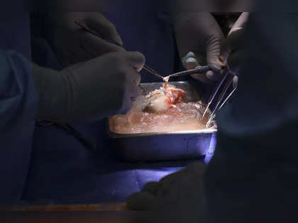 Big news for Kidney patients: Pig kidney successfully transplanted into a living patient
