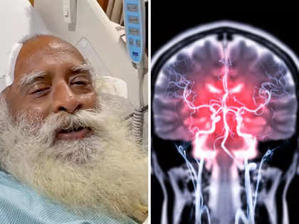 Sadhguru undergoes emergency surgery for brain bleeding; from headaches to photosensitivity, 11 haemorrhage red flags