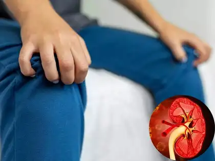 Link between restless leg syndrome and kidney disease found in new research. Who are at risk? Check symptoms