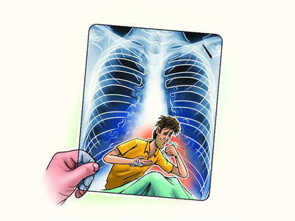 No. of India's TB patients may be double the estimate: Study