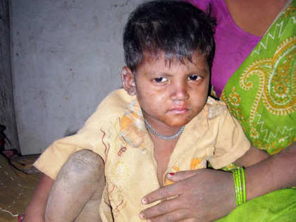 India's future being gutted: Congress slams govt over child malnutrition