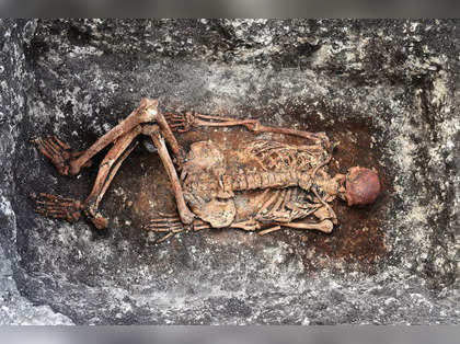 5,000-yr-old skeletons revealed that people suffered from multiple sclerosis in ancient times