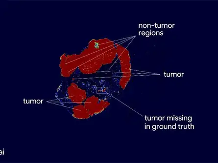 Advances in ML can also be applied to healthcare, improving detection algorithms and naturally complementing how pathologists work
