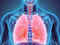 'Unusual' form of cell death underlies lung damage in Covid patients, finds study:Image