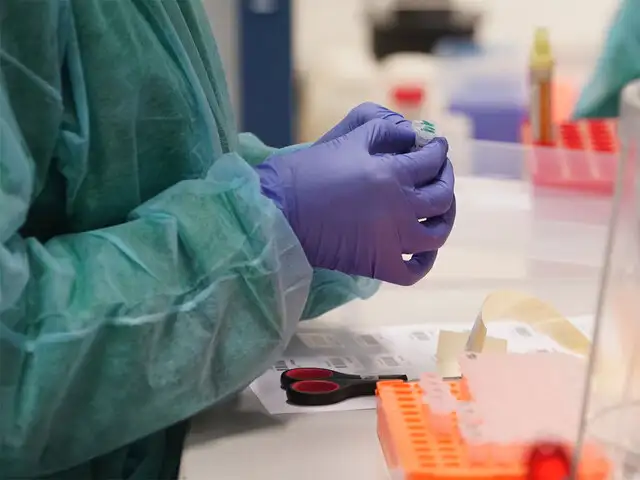 Coronavirus Test Don T Have Wherewithal To Do Covid 19 Tests Free Of Cost Expect Govt To Come Up With Modalities For Sustainable Testing Pvt Labs The Economic Times