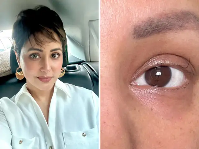 Hina Khan's last remaining eyelash has become a powerful motivation for her  in her fight against cancer - The Economic Times