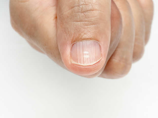 Fingernail Diagnosis Chart