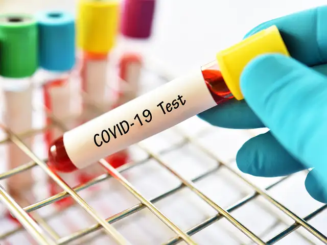 Covid 19 Origin Wuhan Virology Lab Chief Denies Covid 19 Originated From Institute Says Virus Cannot Be Man Made The Economic Times