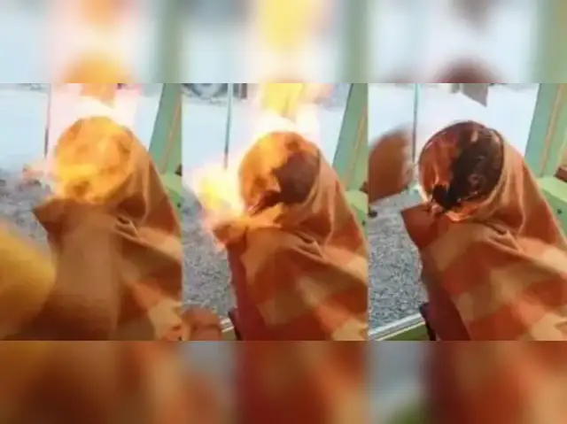 Fire haircut News: Fire haircut goes horribly wrong, Gujarat teen suffers  severe burns - The Economic Times